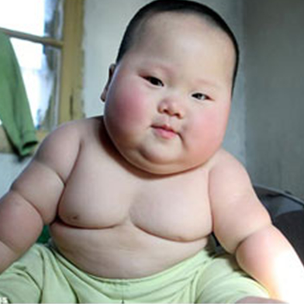 ผู้เชี่ยวชาญเตือน "ลูกอ้วน" เป้าเสี่ยงโครงสร้างผิดรูป!